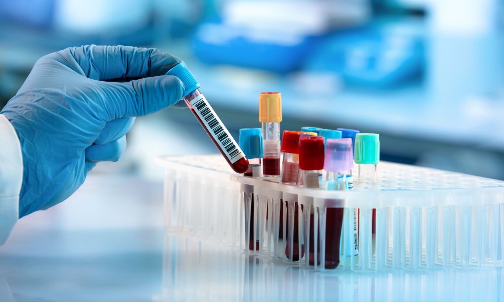 Theranos